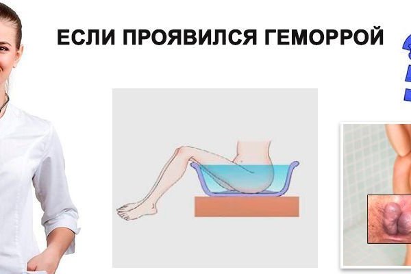 Тор для кракена